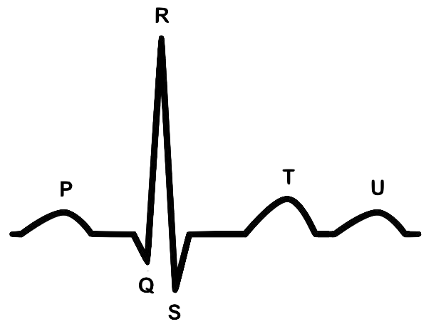 ECG Waveform - ProMedCert