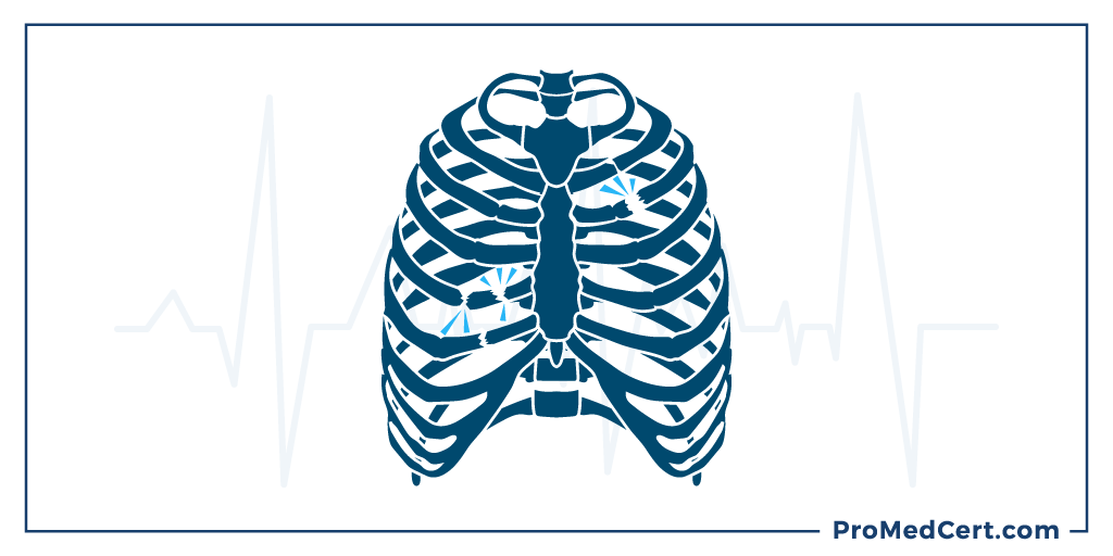 Who-is-most-at-risk-of-breaking-or-fracturing-a-bone-during-CPR_