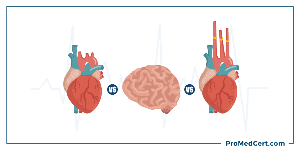 Cardiac Arrest vs. Heart Attack vs. Stroke