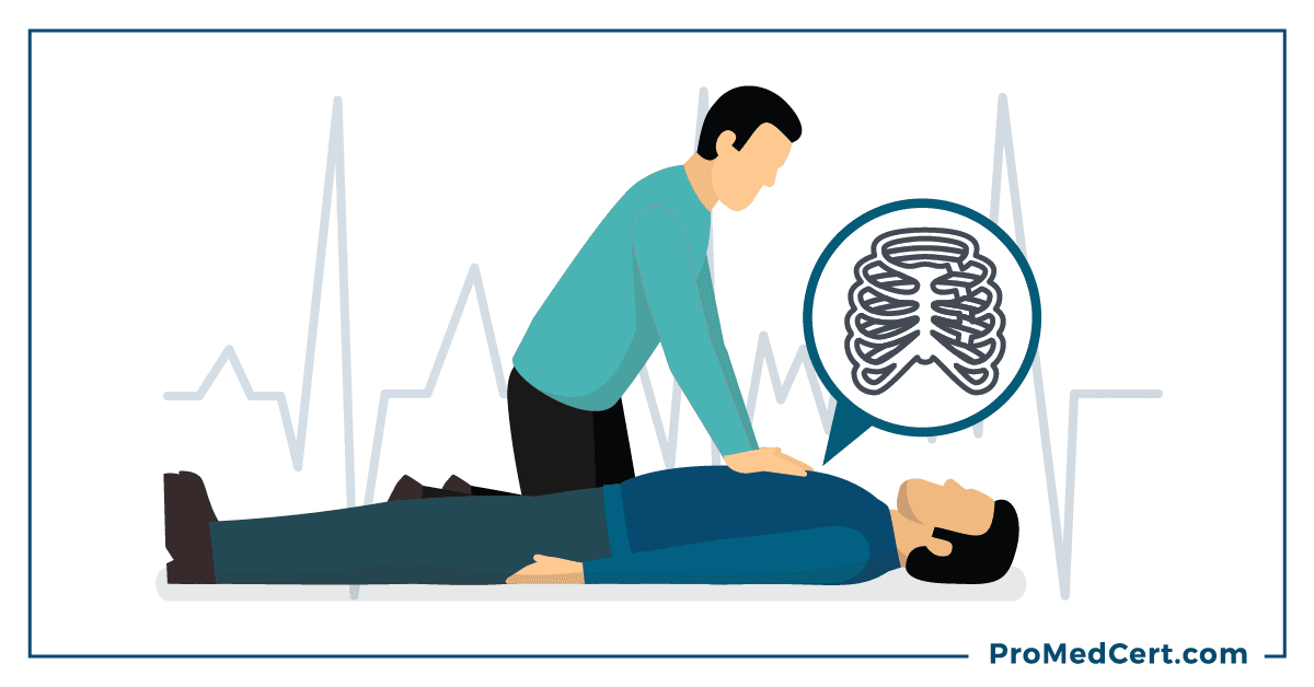 A man receiving CPR from another man and a graphic of ribs between them.